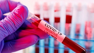 SAĞLIK BAKANI KOCA'DAN KORONAVİRÜS AÇIKLAMASI