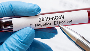 SAĞLIK BAKANI ÖLÜM VE VAKA SAYILARINI AÇIKLADI